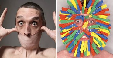 Может натянуть кожу с шеи на рот: рекордсмен Книги рекордов Гиннеса имеет редкое заболевание (фото)