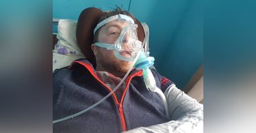 Відмирає кісткова тканина: у дизайнера Олексія Залевського виявили важке захворювання