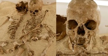 Науковий прорив: у дівчинки, яка жила 12 000 років тому, виявлено рідкісну хворобу (фото)