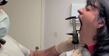 Жінка з найбільшим ротом у світі показала дива, на які здатна (фото)