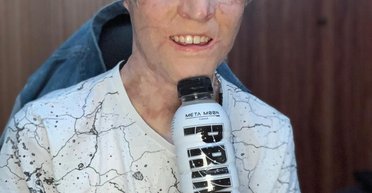 Підліток, якого дитиною підпалив його батько, знявся в бойовику з Крісом Гемсвортом