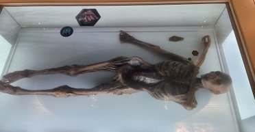 Ледяная мумия Этци была заражена вирусом папилломы человека: ученые это доказали