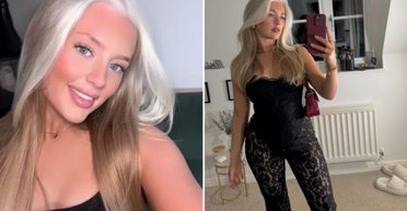 Унікальна зовнішність від народження: дівчина з білим пасмом з роками дізналася правду про себе