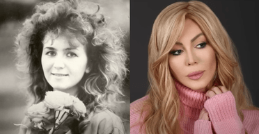 Ірині Білик — 56. Як пластичні операції змінили зовнішність співачки (фото)