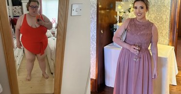 Щовечора з'їдала по 10 плиток шоколаду: жінка схудла на 120 кілограмів (фото)