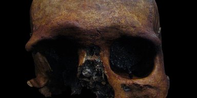 Покушения на жизнь и опухоль: что узнали ученые, исследовав череп эпохи Римской империи (фото)