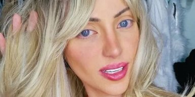 Хотіла стати "живою Барбі": загадково померла 31-річна блогерка, яка зробила 27 пластичних операцій