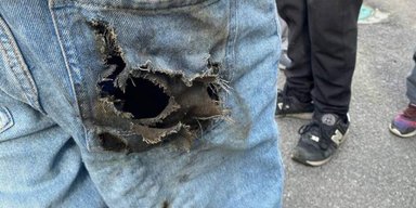 Деталь от "Шахеда" прожгла штаны: на Киевщине пострадал подросток (фото)