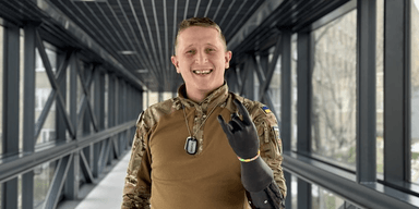 "Чиновникам все равно": бойцы с ампутациями вынуждены сами искать средства на протезы, — волонтер