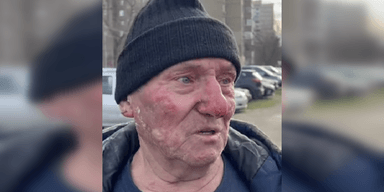 У Києві помер сміливець, який відігнав власну машину у вогні після "прильоту" (відео)