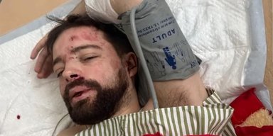 Скандал з лаборантом із Львівського університету: чи дійсно його побили представники ТЦК