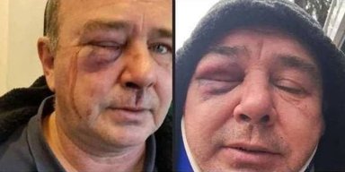 В Киевской области работники ТЦК жестоко избили мужчину на глазах у полиции,  — соцсети (фото)