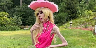 Блогерка YouTube з анорексією приміряла вбрання Барбі та викликала співчуття підписників (відео)