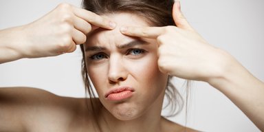 Як позбутися прищів на лобі: 8 домашніх засобів, які варто спробувати
