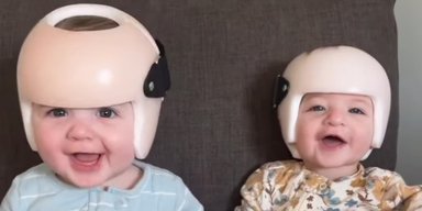 Близнюки проводять у шоломах 23 години на добу: мама все пояснила (відео)