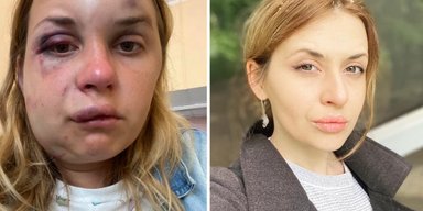 Мое купе – не моя крепость: в соцсетях обсуждают нападение на Анастасию Луговую