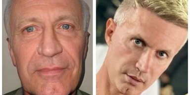 Турецкий "Бенджамин Баттон" помолодел на 40 лет после пластических операций (фото)