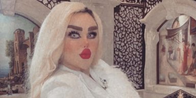 Женщина решилась на 43 пластические операции, чтобы превратиться в Барби (фото)