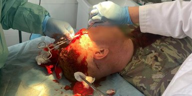 "Швыряли камни и кирпичи": на Закарпатье местные напали на пограничников (фото)