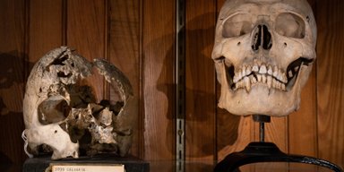 Ученые рассказали, что происходит с зубами после смерти человека