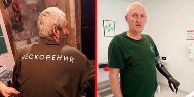 Рекордна воля до життя українського піхотинця