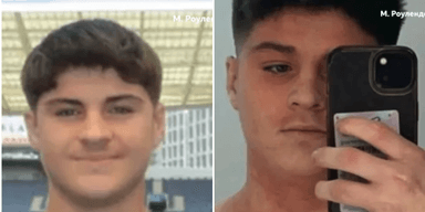 21-летний парень перестал пользоваться кремом — теперь он не может встать с постели (фото)