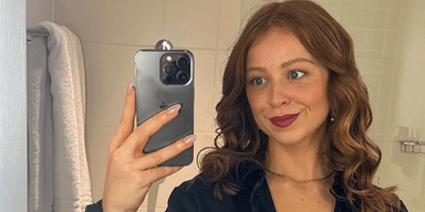 Стала больше есть: женщина так сильно похудела, что у нее начали выпадать волосы (фото)