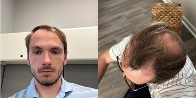 Наважився і не прогадав: новий образ чоловіка викликав захоплення у мережі (фото)