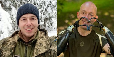 "Підривник вибухнув в руках. Я побачив: кінцівок нема", – як ветеран після ампутації відкрив власний бізнес