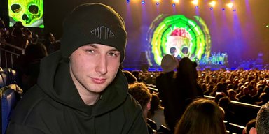 Лисий юнак зважився пересадити волосся: "побочка" змінила його до невпізнання (фото)