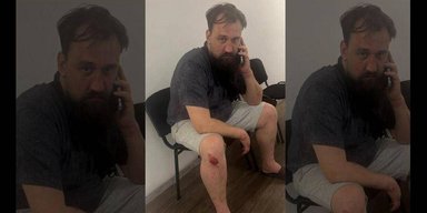 Известный волонтер Денис Кошельник в состоянии опьянения попал в ДТП