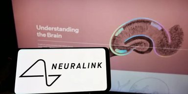Перший пацієнт з чипом Neuralink одужав та керує курсором на екрані силою думки, — Маск