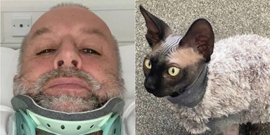 "Повезло выжить": споткнувшись из-за кота, мужчина получил травмы, как в автокатастрофе (фото)