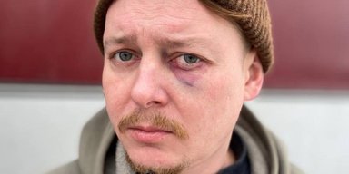 "Вот это съездили на гастроли": в Днепре директор театра избил актера из Чернигова
