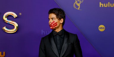 Канадский актер появился на премии Эмми с кровавым отпечатком ладони на лице (видео)