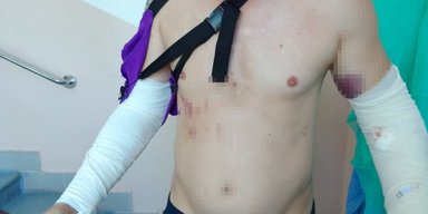 Командир просто дивився: ДБР оголосило підозру інструктору за побиття у навчальному центрі (фото)