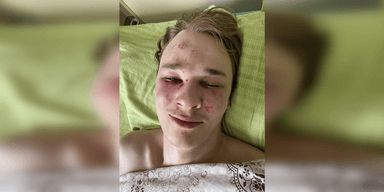 Міг подряпати собі обличчя для симуляції: у ТЦК прокоментували спробу самогубства в туалеті