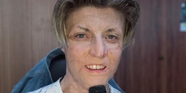 Подросток, которого ребенком поджег его отец, снялся в боевике с Крисом Хемсвортом