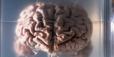 Неограниченный объем памяти. Мы можем наконец узнать, почему у людей такой большой мозг
