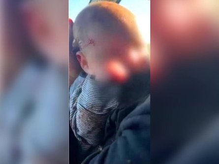 Херсон, ВСУ, война РФ против Украины, Херсонская область, обстрелы городов Украины