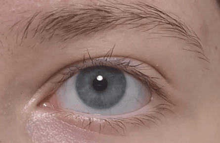 Правый глаз