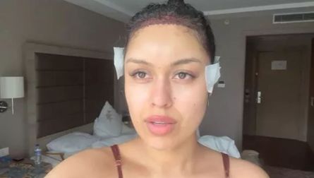 Облысение у женщин, потеря волос, конкурс красоты, внешность, идеал красоты, идеал красоты, трансформация внешности