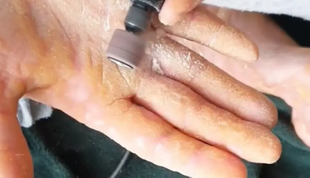 Мария Жампачева, расстройство, странный диагноз, генетическое заболевание, проблемы с кожей, фото, Чехия