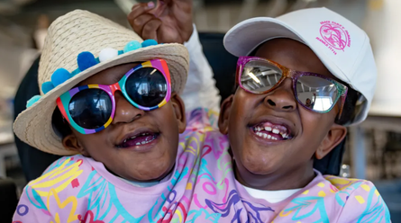 Сіамські близнючки, аномалії, хвороби, діагнози, фото, діти, Велика Британія