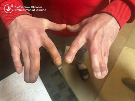 Ситуация в Ужгородском РТЦК