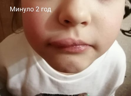 пострадавшая пациентка