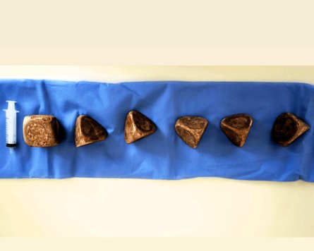 Пірамідовидні утворення