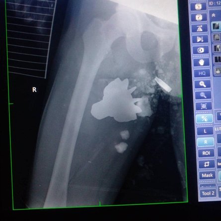 хвостовик мины, операция, военные медики, ВСУ, война РФ против Украины, российское вторжение