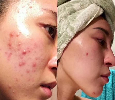 Женщина, которая ест мясо и масло, рассказала, как ей удалось похудеть почти на 14 килограммов, удивительная трансформация тела