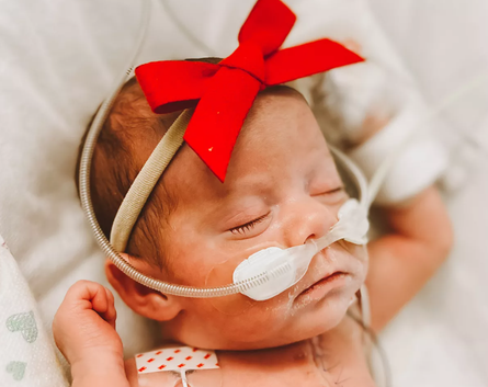 Народження недоношеної дитини, передчасні пологи, Коллін Веймер народила дівчинку з екстремально низькою вагою, США, фото, неймовірна історія з диття